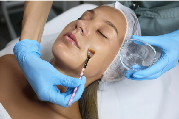 Chemical Peel Treatment