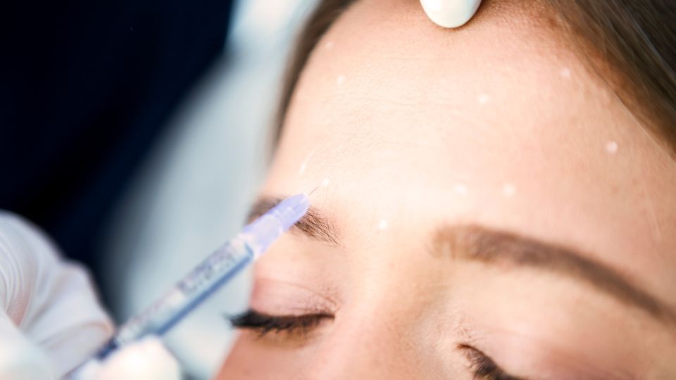 Upper Face Anti-Wrinkle Treatment